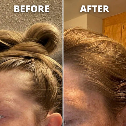 BUY 1 GET 1 FREE Hair Growth Roll-On Serum