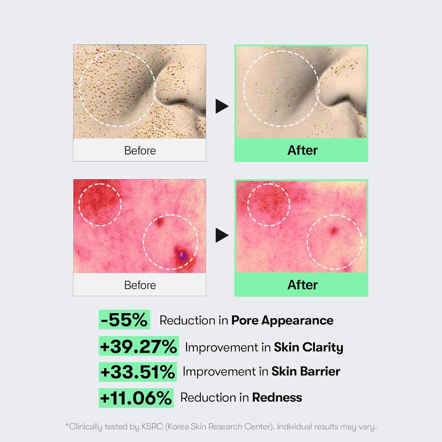 Reedle Shot 100 Serum