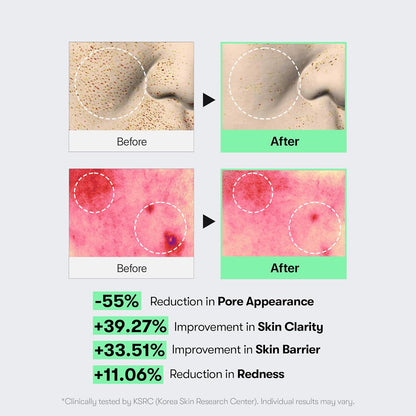 Reedle Shot 100 Serum