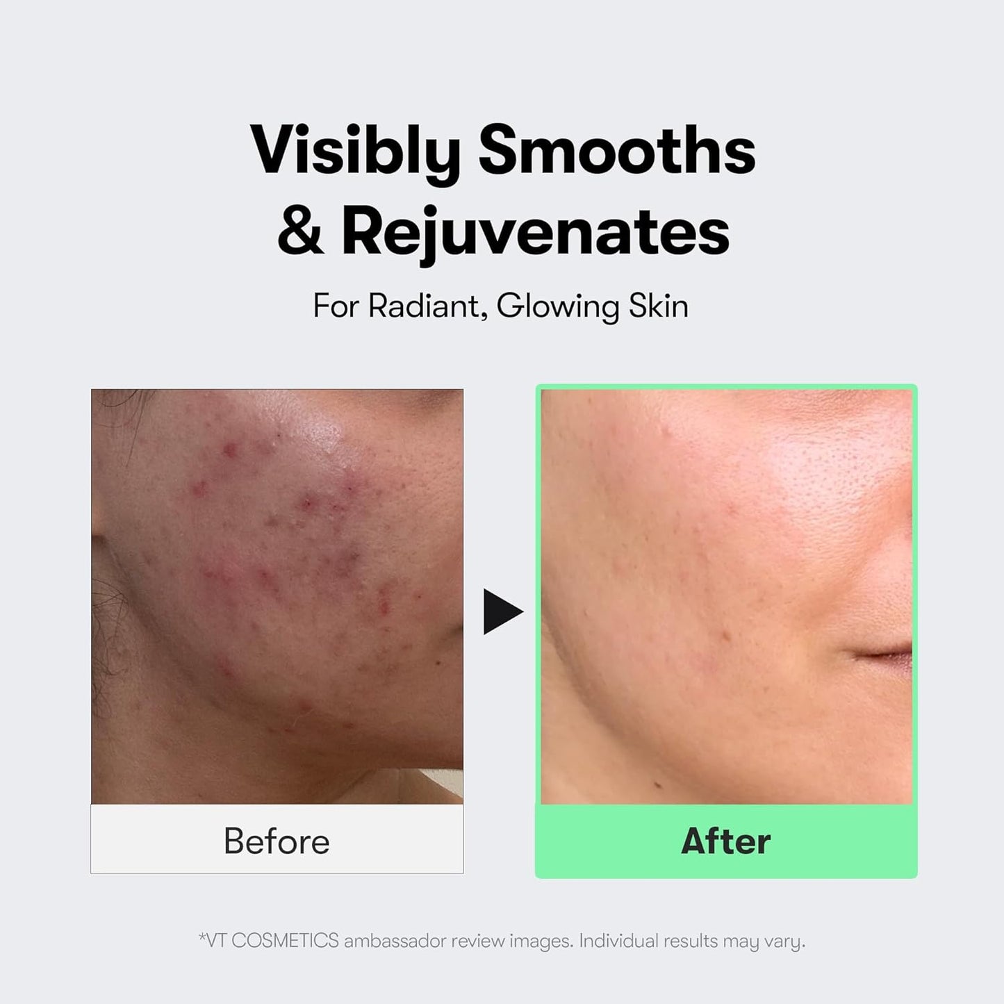 Reedle Shot 100 Serum