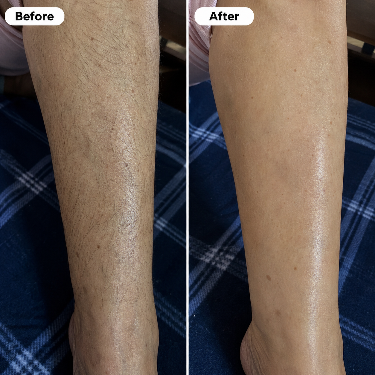 Snatched Gentle Hair Removal Cream for Silky Skin
