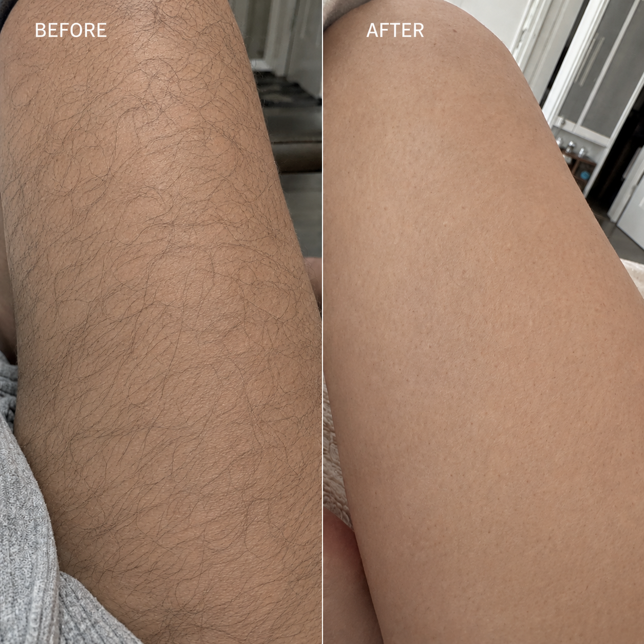 Snatched Gentle Hair Removal Cream for Silky Skin