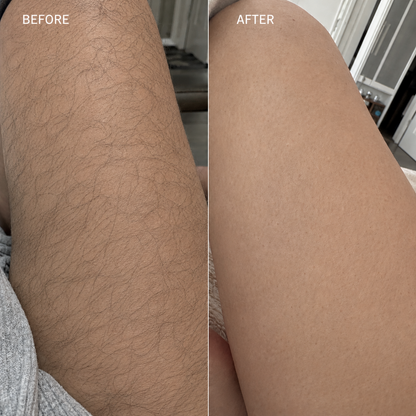 Snatched Gentle Hair Removal Cream for Silky Skin